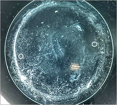 Figure 9. Drying of the lens surface can cause deposits.