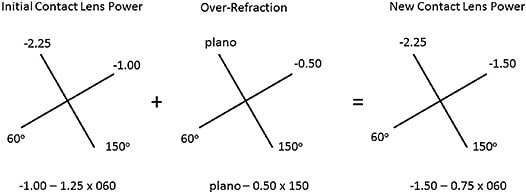 Figure 5. Optical crosses of the contact lens power and over-refraction to calculate the final contact lens power.