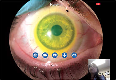 Figure 14. Telehealth communication resources connect practitioners with manufacturer consultants to troubleshoot specialty lens design.