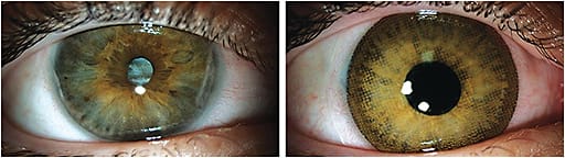 Figure 1. Clinical application of a custom computerized color match process can replicate a high-quality photograph (left) using pad printing to apply multiple layers of pigment to a contact lens to achieve a desired final look (right).