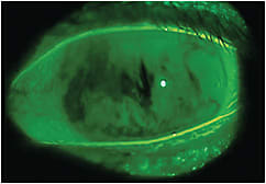 Figure 1. Tear breakup pattern at 3 seconds.