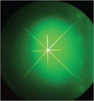 Figure 1. Lens warpage seen with a radiuscope.