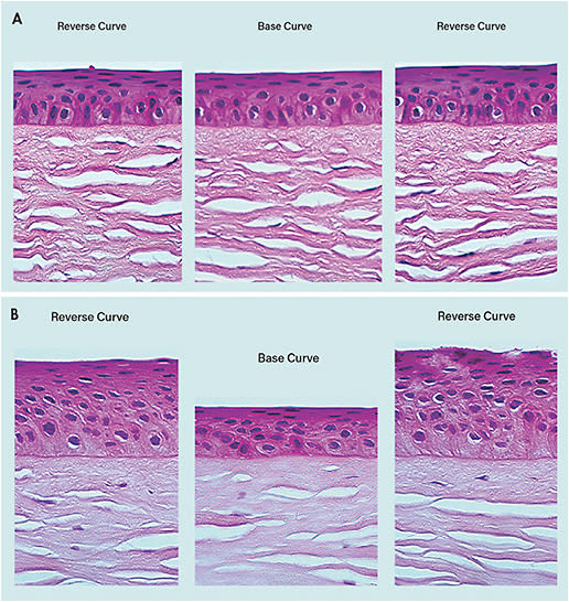 Figure 3. In myopic ortho-k, epithelial tissue of the central cornea thins by movement of intracellular fluid toward the midperiphery rather than actual loss or movement of cells. Histology photos of cat epithelium undergoing myopic ortho-k (A) before and (B) eight hours after treatment. Reprinted with permission of Contact Lens and Anterior Eye