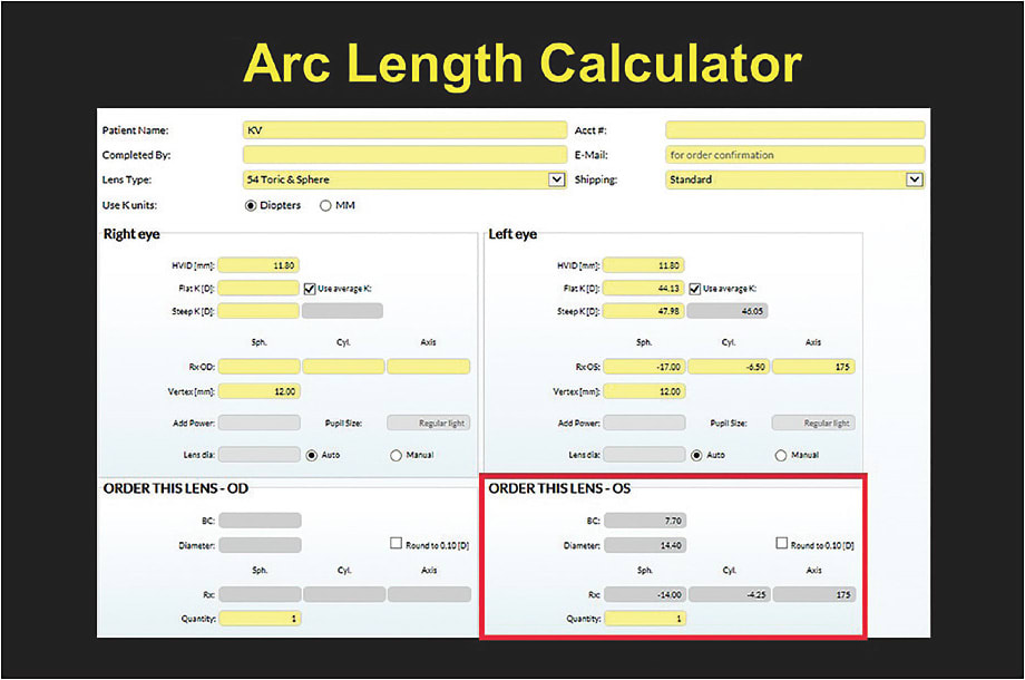 Figure 4. The online Arc Length Calculator for calculating the base curve, power, and diameter of any custom soft contact lens.