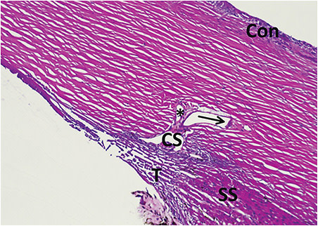 Figure 1. Light micrograph (approximately x200) of a section through a human limbus showing two collector channels emerging from the outer wall of the canal of Schlemm (CS). One collector channel (asterisk) is heading for the conjunctiva (Con) while the other one (arrow) is curving to join the scleral venous plexus. T: trabeculum; SS: scleral spur.
Image published with permission JPG Bergmanson, Clinical Ocular Anatomy and Physiology, 29th Edition, 2022.