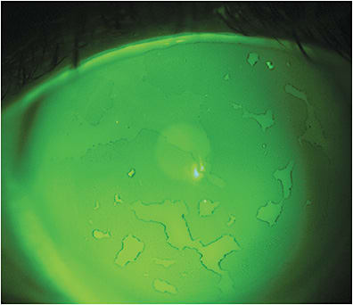 Figure 1. A non-wetting scleral lens surface.