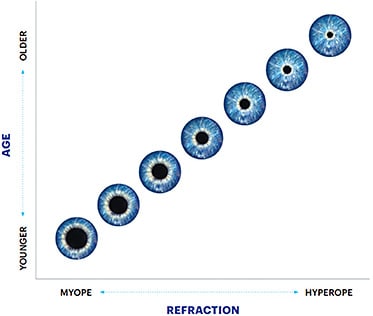 Figure 2. Diagrammatic representation of pupil size change with both age and refraction.