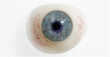 Figure 1. Example of a rigid ocular prosthetic shell.