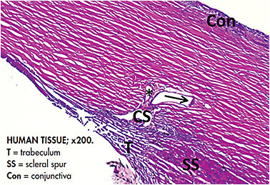 Figure 2. Light micrograph showing two collector channels emerging from the external wall of the canal of Schlemm (CS)—one (arrow) is diverting to the scleral venous plexus deep in the sclera and the other (asterisk) is heading in the direction of the conjunctival venous plexus. Image published with permission from JPG Bergmanson, Clinical Ocular Anatomy and Physiology, 29th Edition, 2022.