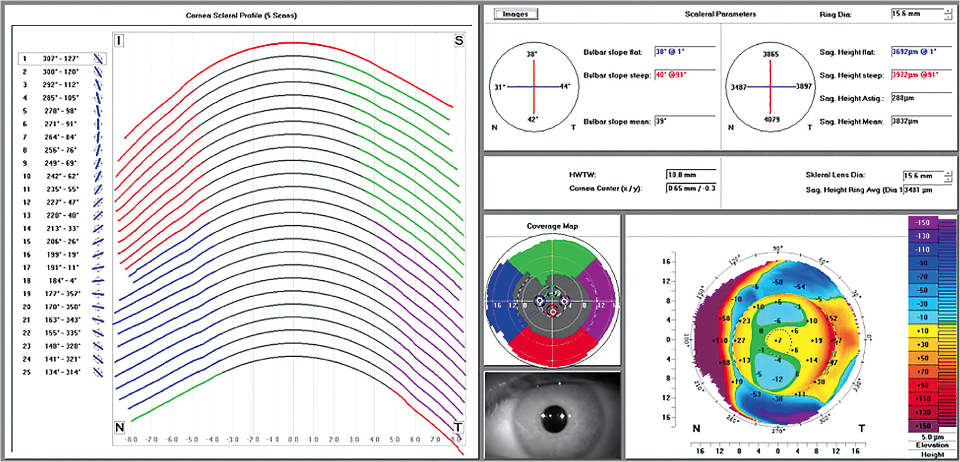 Figure 7. Tomographic profilometry data derived from multiple scans.