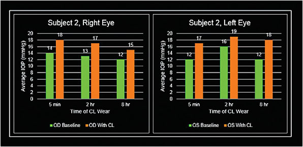 Figure 3. Patient 2 right and left eye measurements.