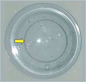 Figure 3. Multifocal scleral lens distance-center (yellow arrow) with various zones identified in a reticule form.