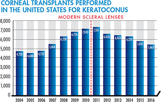 Figure 2. Eye Bank data for keratoplasties for keratoconus from 2004 to 2016.