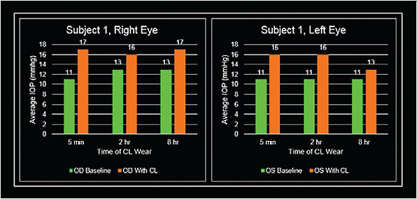 Figure 2. Patient 1 right and left eye measurements.