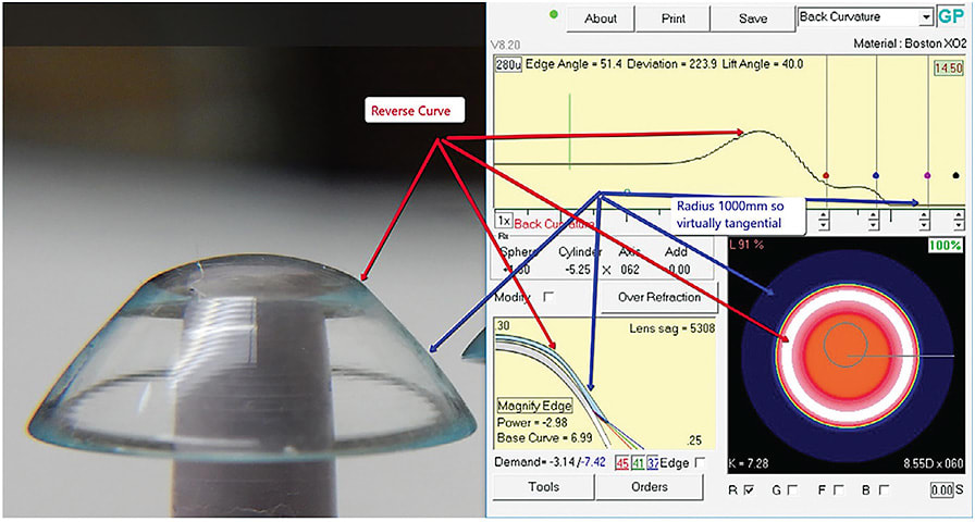 Figure 4. A scleral lens next to the software used to design and create it.