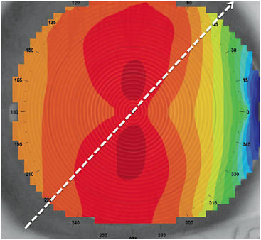 Figure 1. Axial color map. OD = 12.43mm measured visible iris diameter.