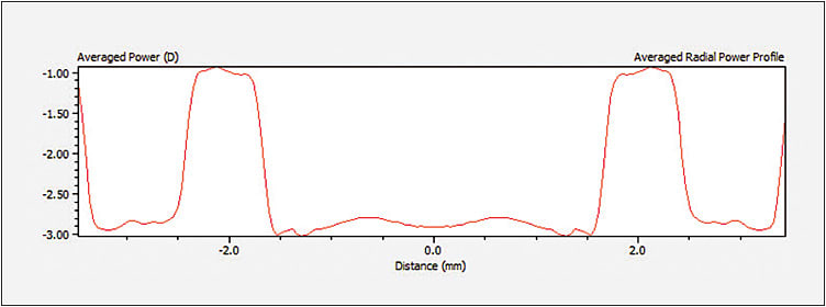 Figure 7. Power profile (–3.00D correction) of the Figure 6 lens design. In this lens, the –3.00D power is located in the center 3mm of the lens (1.5mm from the center of the lens on each side). There is an abrupt, stepped power change toward maximum plus about 2mm from the center of the lens.