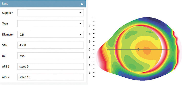 Figure 7. Lens fit parameters for the map on the right. If the needed power is known through prior lens orders, the lens can be ordered empirically without apply a diagnostic lens.