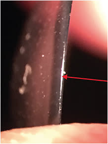 Figure 2. A correctly polished GP lens edge.