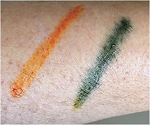 Figure 1. A pH pencil is a handy way to identify which products that contact the skin have an alkaline pH (blue color).