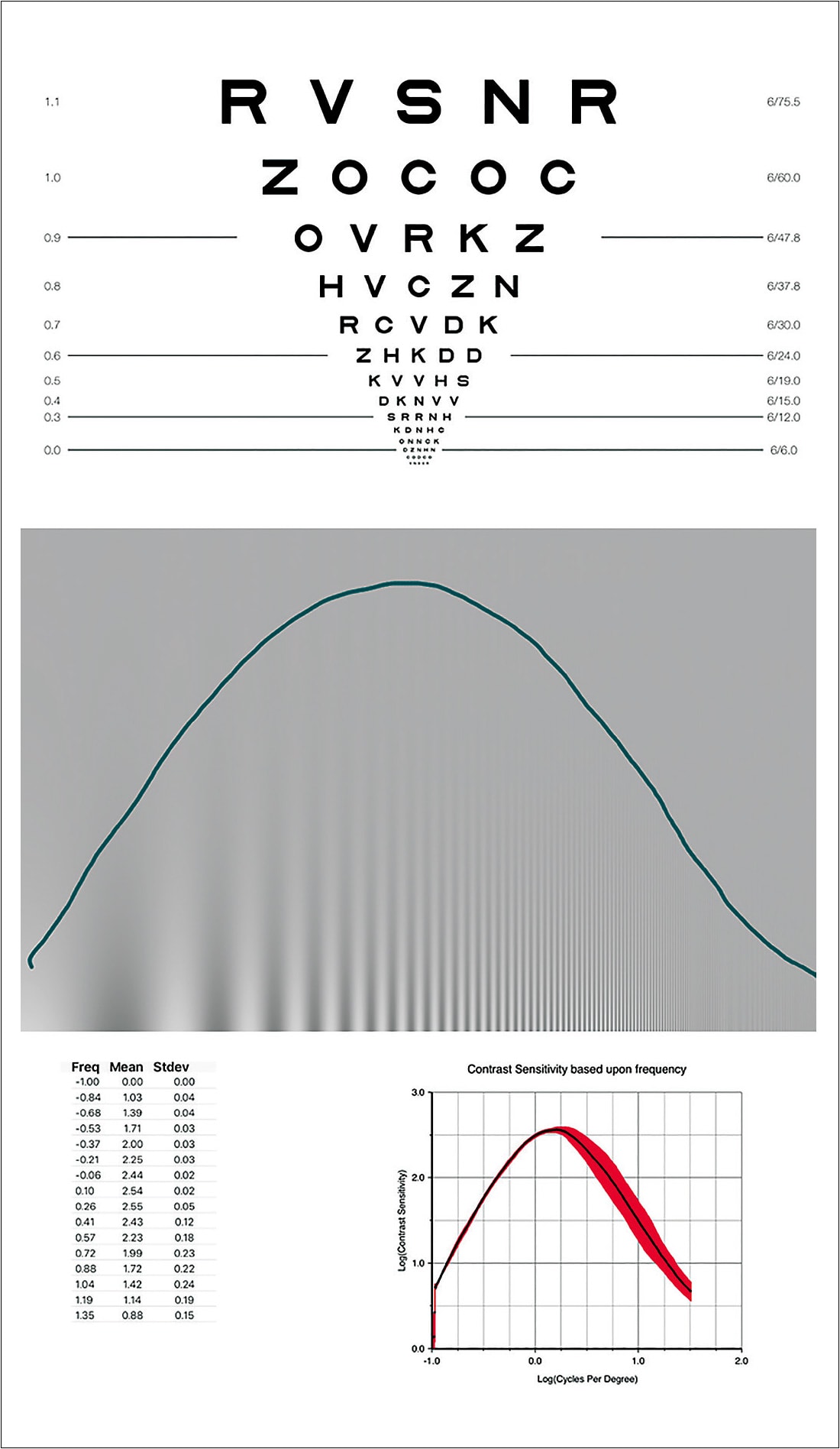 Figure 1. (A) logMAR visual acuity chart; (B) contrast sensitivity function.