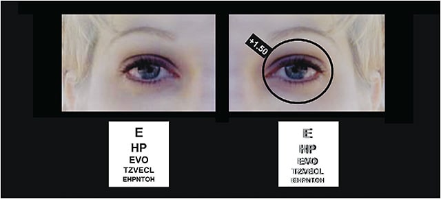Figure 1. If vision is significantly worse when placing plus over one eye, do not add more plus power to the lens for that eye.