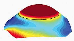 Figure 2. Sagittal height map with significant scleral toricity.