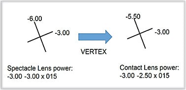 Figure 1. Correcting for vertex distance of the lens power in the spectacle plane onto the corneal plane for the contact lens power.