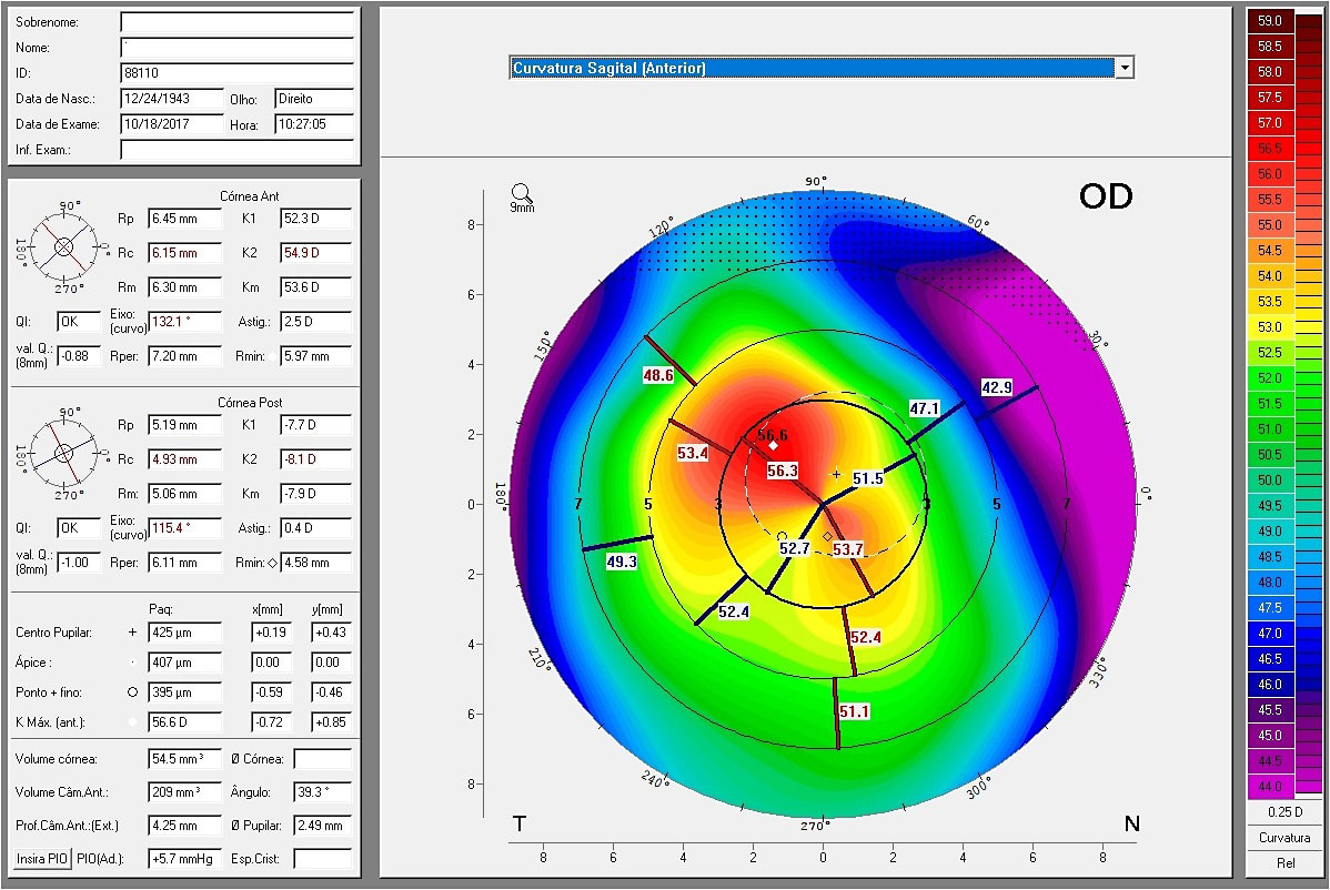 Figure 4. 2017 Sagittal curve map (OD).