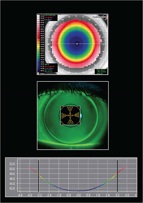 Figure 1. An aspheric center-distance GP lens design.