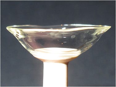 Figure 4. A customized scleral lens designed with landing zone asymmetry and a localized vault.