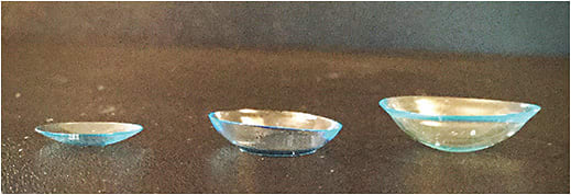 Figure 1. Common lenses used to fit astigmatic corneas, including GP lenses, soft toric lenses, and scleral lenses (left to right, respectively).