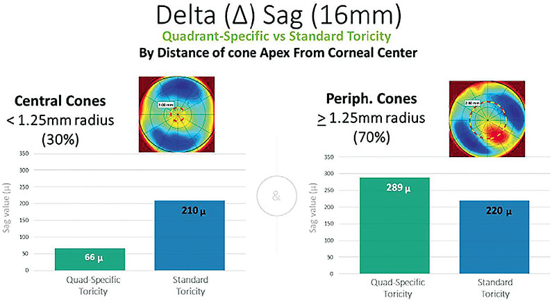 Figure 1. Use of standard peripheral toricity versus quadrant-specific toricity scleral lens designs based on the location of the cone apex of keratoconus patients (DeNaeyer et al, 2019). Image courtesy of Greg DeNaeyer, OD