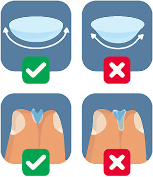 FIGURE 2. Conventional approach to checking lens orientation (top) and the “taco” test (bottom).Image courtesy of Menicon.