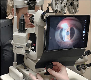 Figure 6. An attached tablet for taking photos. Specific adapters are manufactured for different types of slit lamps.