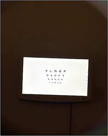 Figure 4. The visual acuity chart with a fully corrected prescription with 1.00D of cylinder corrected.