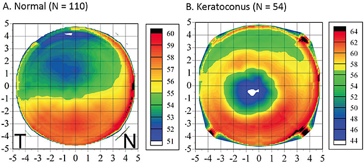 Figure 1. Mean epithelial thickness pro