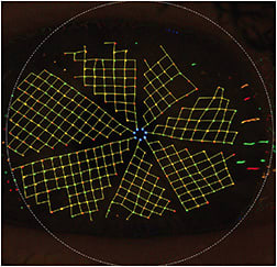 FIGURE 2: Irregular tear film, as shown via Ocular Surface Qualifier. IMAGE COURTESY DEE STEPHENSON, MD, FACS, ABES, FSEE