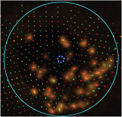 FIGURE 4: Note the distorted LED reflections. IMAGE COURTESY DEE STEPHENSON, MD, FACS, ABES, FSEE