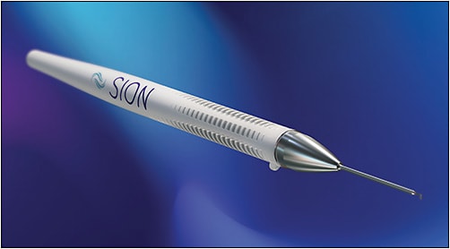 The Sion Surgical Instrument. Image courtesy of Sight Sciences, Inc.
