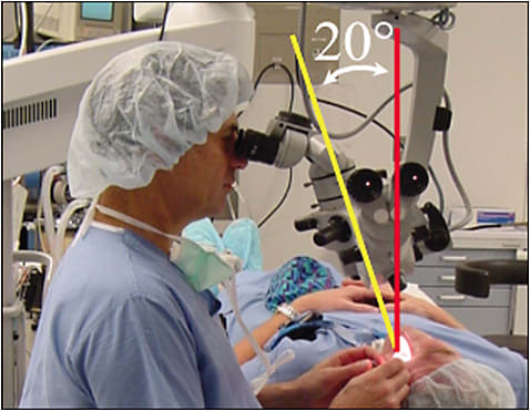 Figure 2. Neutral spinal curvature and reduced musculoskeletal workload with the microscope tilted to accommodate a more neutral posture.