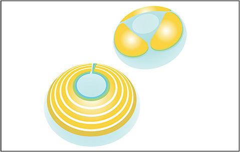 Figure 1. Schematic of the LL-BMT1 drug-eluting contact lens. Image courtesy of MediPrint Ophthalmics.