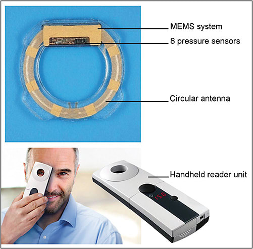 Figure 3. The Eyemate sensor and reader unit (Implandata; MEMS: microelectromechanical systems).