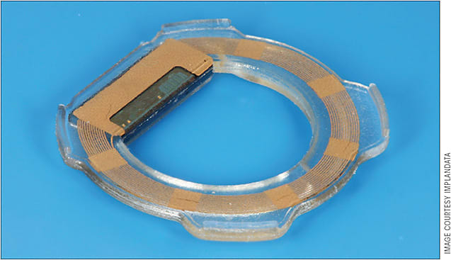 Figure 3. Eyemate implantable intraocular pressure sensor.