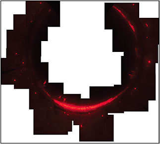 Figure 2. Whole eye (en face) perfused with red fluorescent microspheres where the high (6-o’clock area), intermediate (1- to 2-o’clock area), and low-no flow areas are very distinct.IMAGE COURTESY OF JANICE VRANKA, OREGON HEALTH &amp; SCIENCE UNIVERSITY