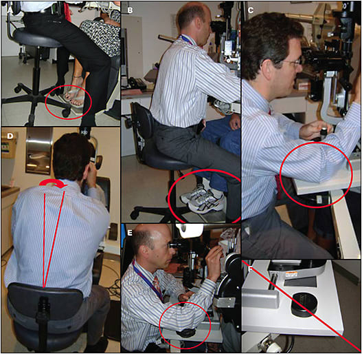 Figure 1. For a slit-lamp exam, the physician’s feet should be positioned flat on the floor with his or her back against the backrest of the chair. Casters on a chair contacting the footrest underneath the patient (A) will cause the physician to lean forward. The patient chair should be elevated so that the casters can slide underneath and the physician can position properly (B). The physician should not place his or her elbow on a hard surface or bend sideways in the chair (C, D). It is better to use a soft cushion to decrease the contact stress on the elbow (E). Avoid using the hard lens case as an elbow rest (F). Additionally, it is preferable to move the chair instead of leaning the torso from side to side while using the slit lamp.
