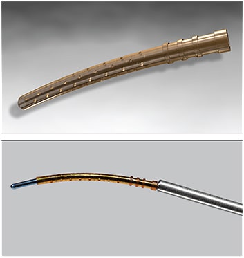 Figure 1. The CyPass System (Alcon) consists of the CyPass Micro-Stent (top) and CyPass applier (bottom), which is used to implant the CyPass Micro-Stent in the eye through the same incision used for cataract surgery.