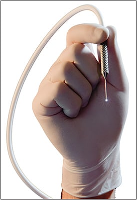 Figure 1. The BVI Endo Optiks probe used for endoscopic cyclophotocoagulation (ECP) contains a diode laser, fiber optic light source, and camera.