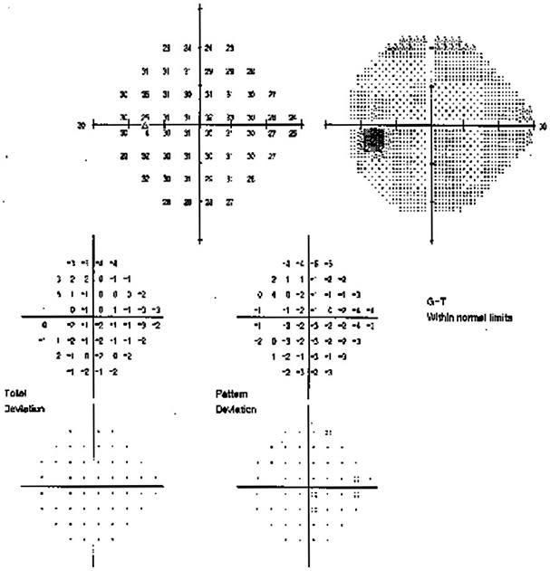 Standardization in testing is the only way to ensure quality images and repeatability.