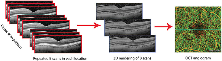 Figure 1. OCTA is built from OCT scans.